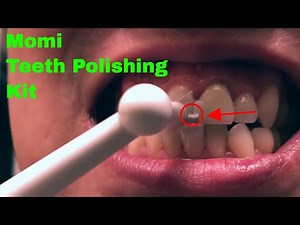 ✅ How To Use Momi Premium Tooth Polishing Kit Review