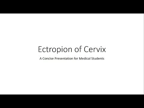 Ectropion (erosion) of Cervix - Gynecology for Medical Students