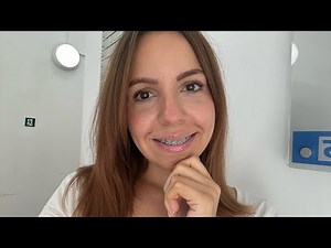 New Top Wire To Fix My Overbite | Bright Colours | Adult Braces Journey