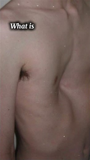 🤯🤯🤯🤔#medicalstudent #skincare #students #biology