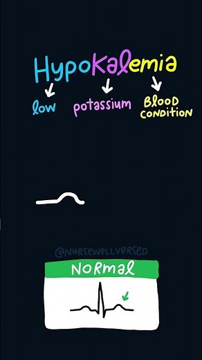 Hyperkalemia vs Hypokalemia EKG Changes🫀 #nursingeducation