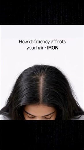 Your hair is not the problem… your nutrition might be.