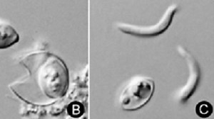 At least 82 cases of intestinal parasite illness cyclosporiasis reported in Austin-Travis County