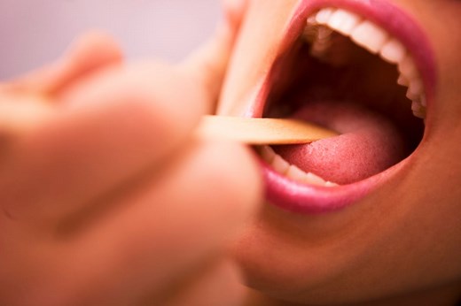 Hypersalivation : d'où vient cet excès de salive ? quelles solutions ?