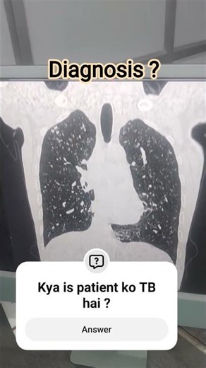 CT THORAX #angiography #diagnosis #doctor #ctscan