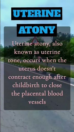 Uterine Atony#obstetricsandgynaecology #nursing #shortvideo #shorts #yt #uterusproblem #pregnancy