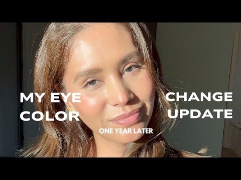 Changing My Eye Color Permanently Chapter 2 | My 1 Year update Vlog