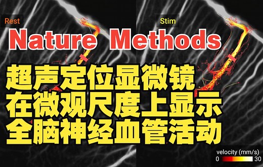 Nature Methods | 超声定位显微镜在微观尺度上显示全脑神经血管活动