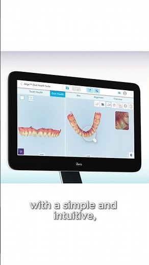 Elevate patient conversations with the Align™ Oral Health Suite and iTero™ intraoral scanner