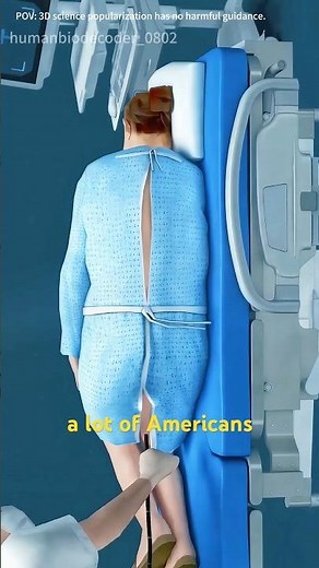 Colonoscopy Procedure!!(3D Animation) #science #3danimation #doctor #3dmodeling #anatomy