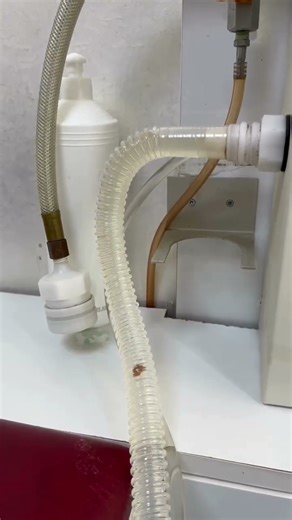 BAĞIRSAKTAN ÇIKANLARI GÖRÜNCE ŞAŞIRACAKSINIZ!