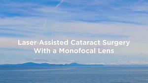 Laser-Assisted Cataract Surgery