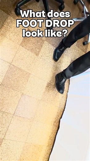 What Does Foot Drop Look Like? A Clinician Demonstrates
