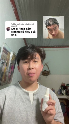 Trả lời @Học bá rau má còn nang là mọc được thui em ơi, anh rụng đến thế mà vẫn mọc được mờ #leannhien #rungtoc #hoidau #minoxidil
