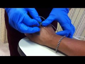 My Blood test done on my hand