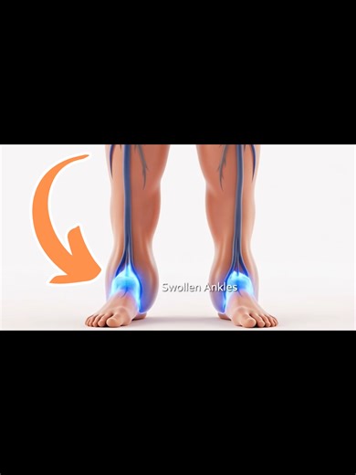 Activate Your Lymphatic System for Swollen Ankles