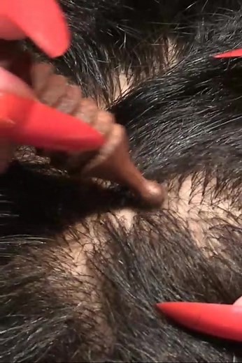 ASMR Tingly Scalp Check #asmr #scalpcheck #scalp #relax #calm #sleep #asmrscalpcheck #scalp #tingles #tingly #sleepy #hair #asmrsounds #asmr_tingles