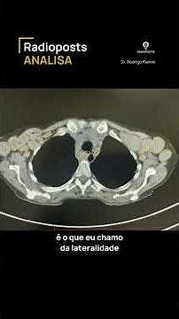 Come along with me as we explore this non-contrast chest CT scan with a mediastinal window.