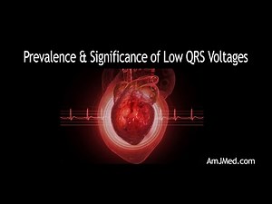 Prevalence & Significance of Low QRS Voltages