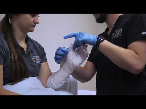 Thumb Spica Splint - Proliance Orthopaedics & Sports Medicine