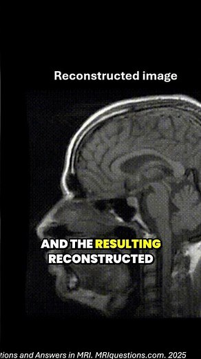 MRI K‑space explained