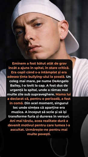 Eminem a ajuns în stare critică după ce a fost lovit la cap