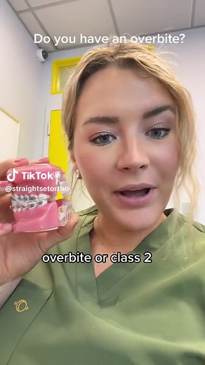 Class 2 bite! #overbite #braces #class2bite #rubberbands