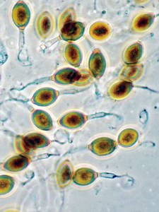 Podospora anserina - Alchetron, The Free Social Encyclopedia