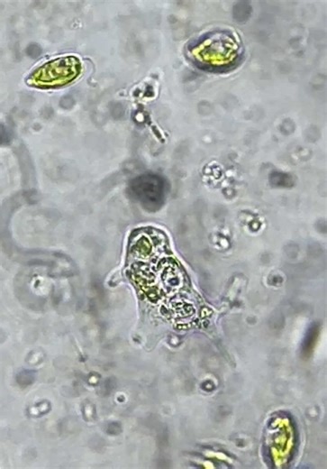 Amoeba Phacus Euglena เจอ3ตัวนี้พร้อมกันเเสดงว่าในบ่ออินทรีย์วัตถุสูง เขียวปี๋ ตะกอนก็เยอะ เริ่มไม่ดีละ ดูดเลนออกเเละเปลี่ยนถ่ายน้ำด่วนจี๋เลยยยยย! 🦠❤️‍🔥
