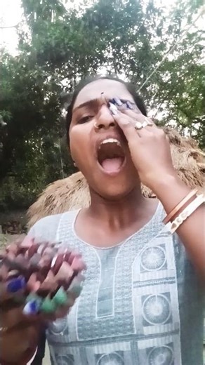 Pineapple Bite Gone Wrong! Straight to the Eye! 😂🤣😂😂😁😁😁😁😁😁