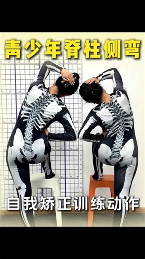 脊柱侧弯家长必看、改善体态、预防侧弯加重 #脊柱侧弯 #青少年脊柱侧弯 #青少年脊柱侧弯矫正 #体态 #体态纠正