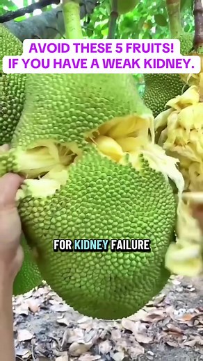 5 Fruits to Avoid for Weak Kidneys