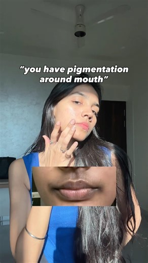 DARKNESS AROUND THE MOUTH‼️ check description #pigmentation #darkness #darklips #skincare #skin