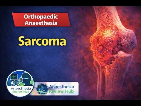 Sarcoma and Anaesthesia | Orthopaedic Anaesthesia | Anaesthesia Review Hub