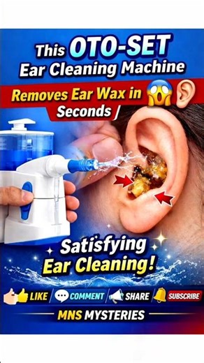 This OTO-SET Ear Cleaning Machine Removes Ear Wax in Seconds 😱👂 | Satisfying Ear Cleaning #coolgaget
