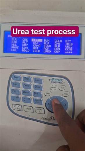 Urea Test in 60 Seconds! 🔬 #LabLife | Urea test full procedure