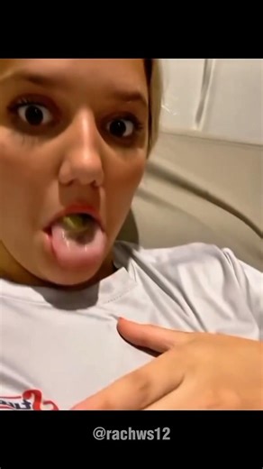 Frog Moments That Will Make You Laugh So Hard 🤣🐸 | Funny Compilations.