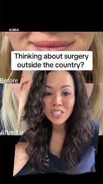 I know there are really good surgeons and clinics everywhere in the world, so I hate to generalize