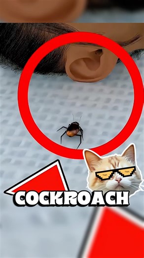 😱 Cockroach Crawled Into Your Ear?! Here’s What To Do FAST!