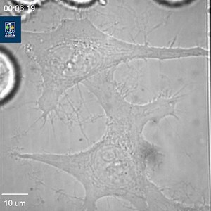 🌟 MVLS Under the Microscope 🌟 Under the lens of a brightfield microscope, HeLa cells—iconic in cancer research—are captured undergoing apoptosis (programmed cell death) following chemotherapy treatment. 💊 This cutting-edge insight helps our researchers at #MVLS understand how cancer therapies work at the cellular level, paving the way for more effective treatments. 🧬 🔬 HeLa cells are derived from one of the most important cell lines in science, originating from cervical cancer cells taken i