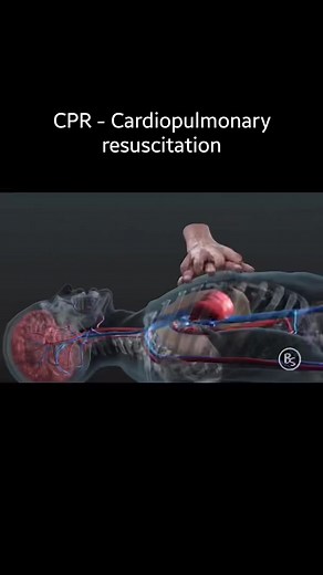 9.9K views · 252 reactions | CPR -cardiopulmonary resuscitation | Doctor's Life | Facebook
