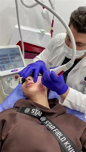 Fractional RF for Skin Toning and Boosting Benefits