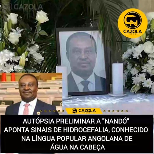 Cazola News on Instagram: "💥💥AUTÓPSIA PRELIMINAR A "NANDÓ" APONTA SINAIS DE HIDROCEFALIA, CONHECIDO NA LÍNGUA POPULAR ANGOLANA DE ÁGUA NA CABEÇA Luanda – Os resultados parcelares da autópsia ao antigo Vice-Presidente da República de Angola, Fernando da Piedade Dias dos Santos, conhecido por “Nandó”, indicam a presença de hidrocefalia, uma condição caracterizada pela acumulação excessiva de líquido cefalorraquidiano (LCR) no interior do cérebro. De acordo com informações apuradas, esta condição