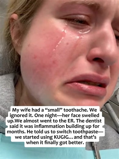 Five months ago… my wife kept complaining about a toothache. We thought it was nothing. Just sensitivity. Then one night… everything got out of control. Her face was swollen, she couldn’t even sleep— we were this close to rushing to the ER. At the clinic, the dentist told us it didn’t start overnight. It was daily inflammation building up the whole time— and we completely ignored it. He said oral health isn’t just about your teeth, it can affect your whole body. After that, he told us to stop us