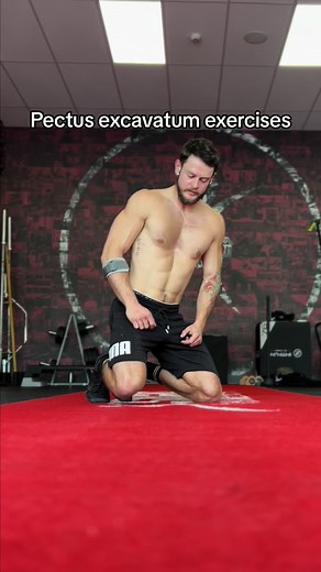 Effective Pectus Excavatum Exercises for a Stronger Chest