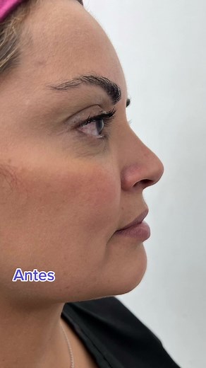 Medicina Estética Integral MD on TikTok