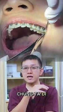 Quy trình niềng răng gắn mắc cài🦷✨