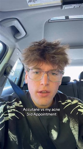 Brady Shepherd on Instagram: "Bro said my lips are suffering😭"