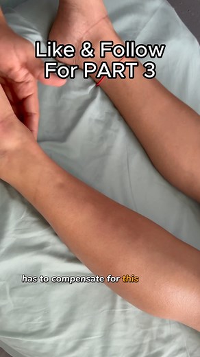 Insane KNOT causes PIGEON TOE Part 2 #pigeontoedproblems #anklebreaker #massagetok | Greater Therapeutics