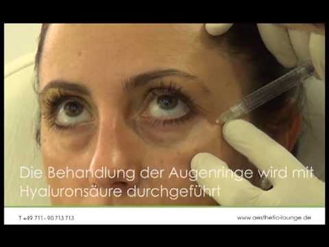 Augenringe entfernen durch Unterspritzung - aesthetic LOUNGE